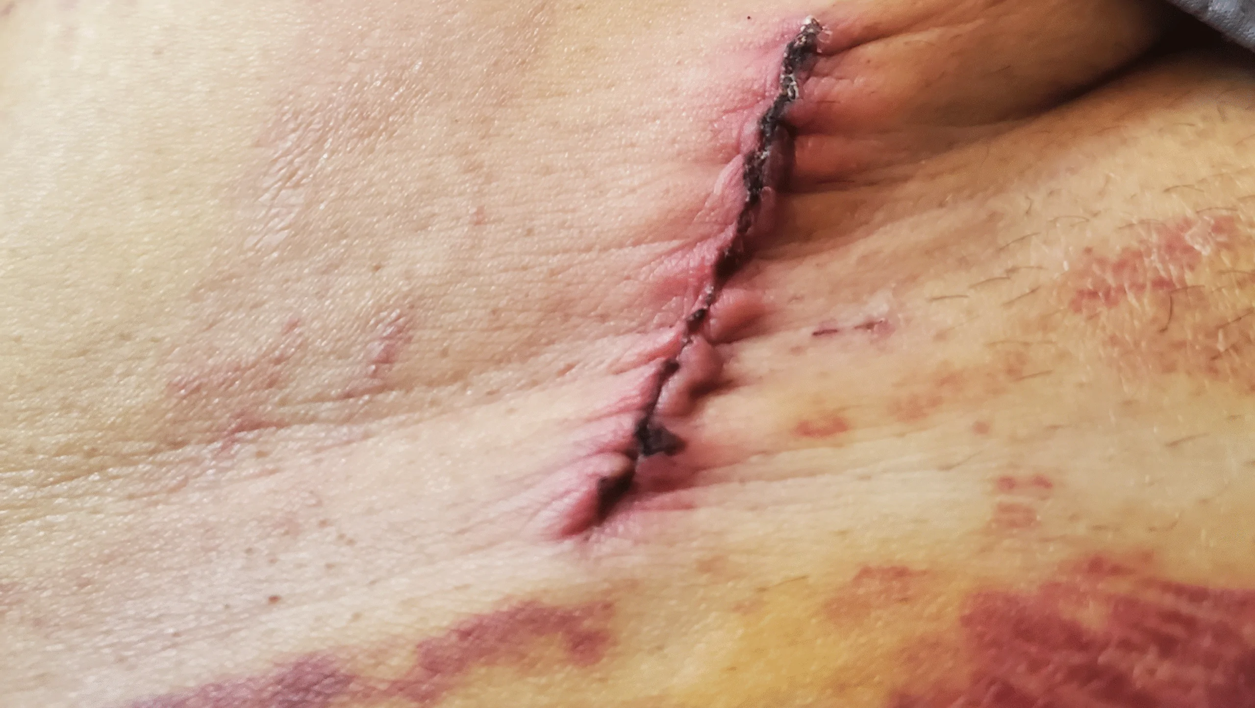 Support David’s Recovery and Medical Care – GoFundMe Fundraiser gofundme Donation Help