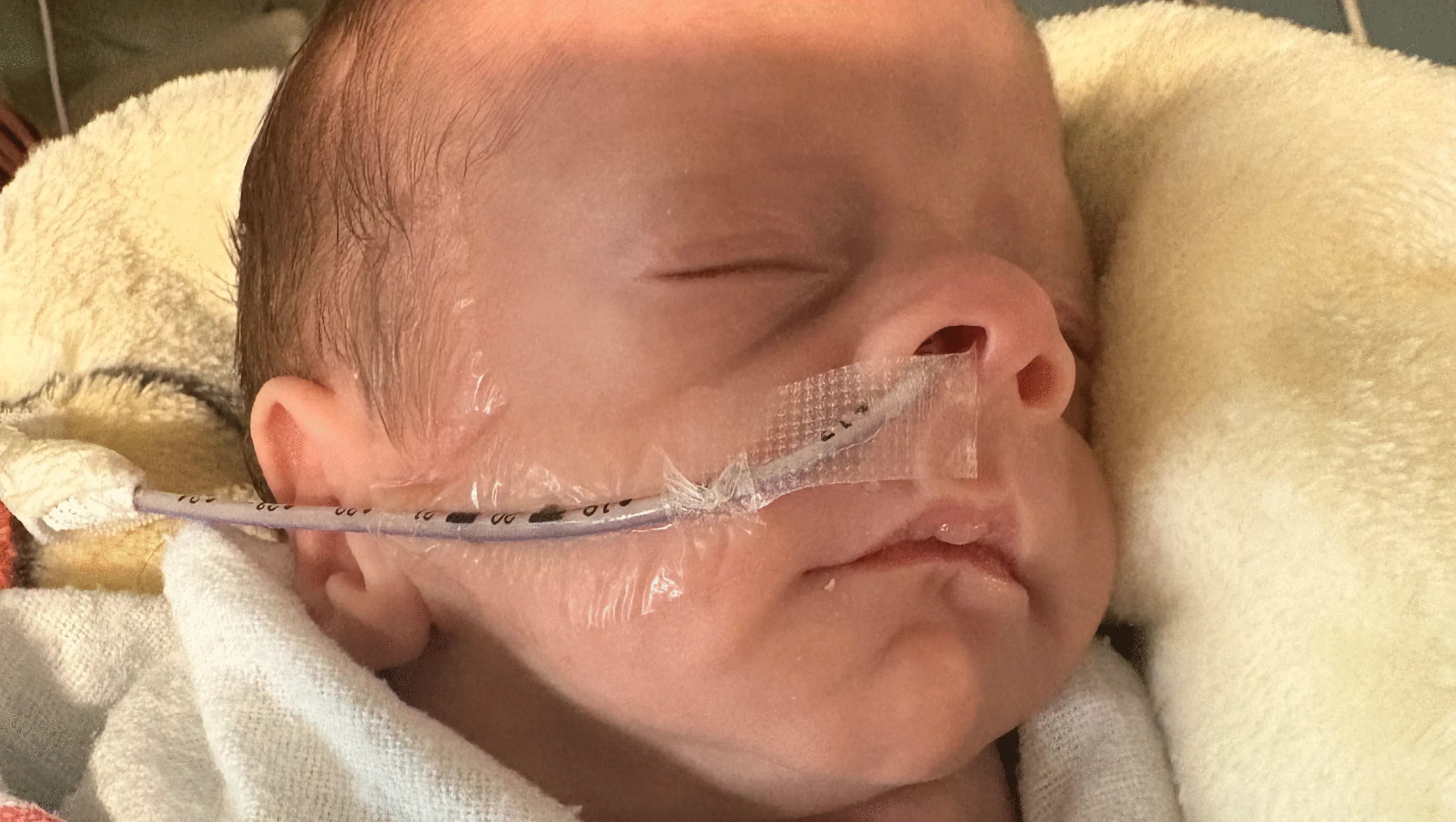 Essential Needs for Our Early Arrival – GoFundMe Fundraiser gofundme Donation Help